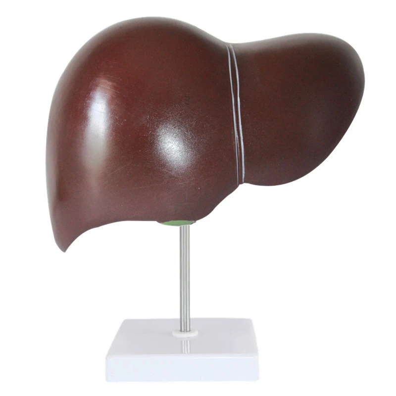 Medical Lab Technology - Medical props model human liver pathological