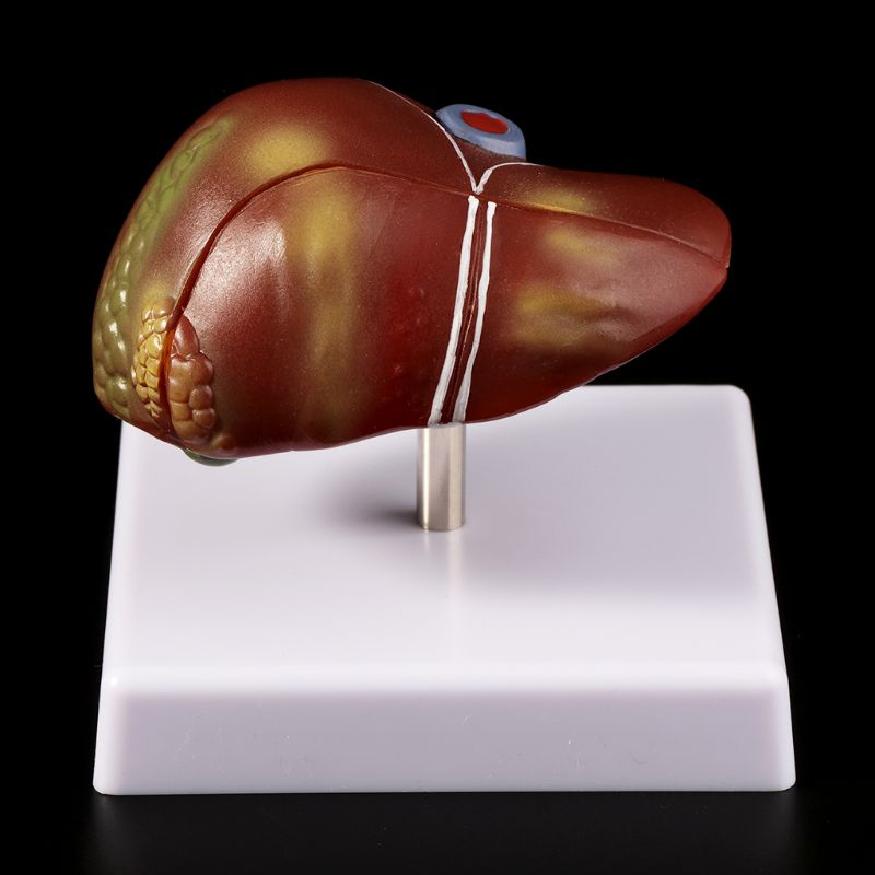 Human Liver Pathological Anato - Medical Lab Technology recension och pris
