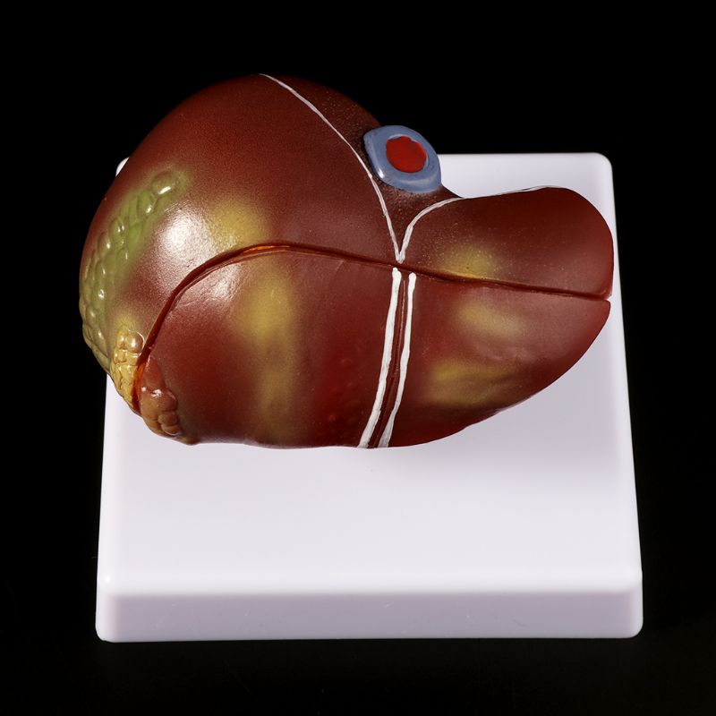 Human Liver Pathological Anato - Medical Lab Technology recension och pris