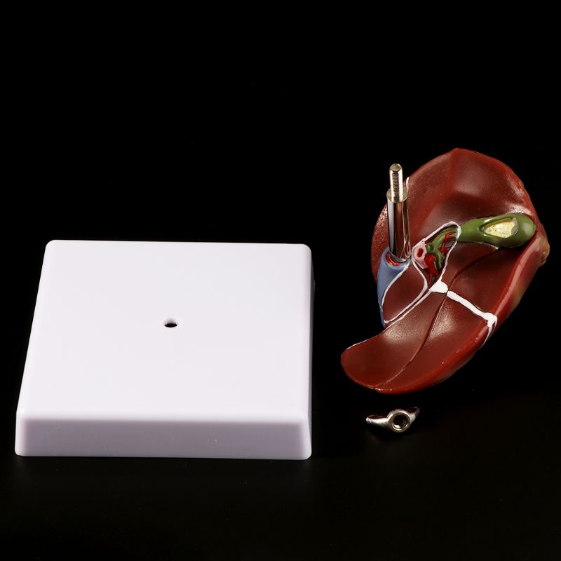 Human Liver Pathological Anato - Medical Lab Technology recension och pris