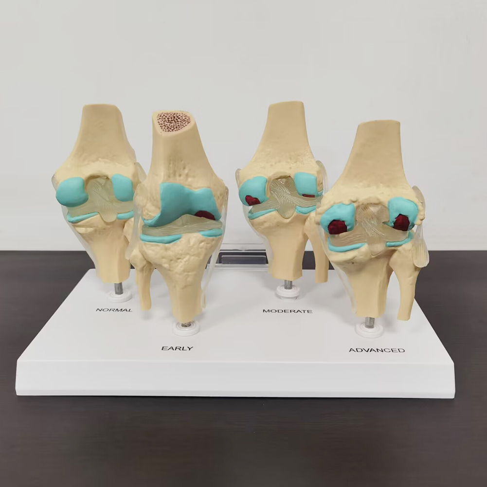 4-stage knee joint model Plast - Medical Lab Technology recension och pris