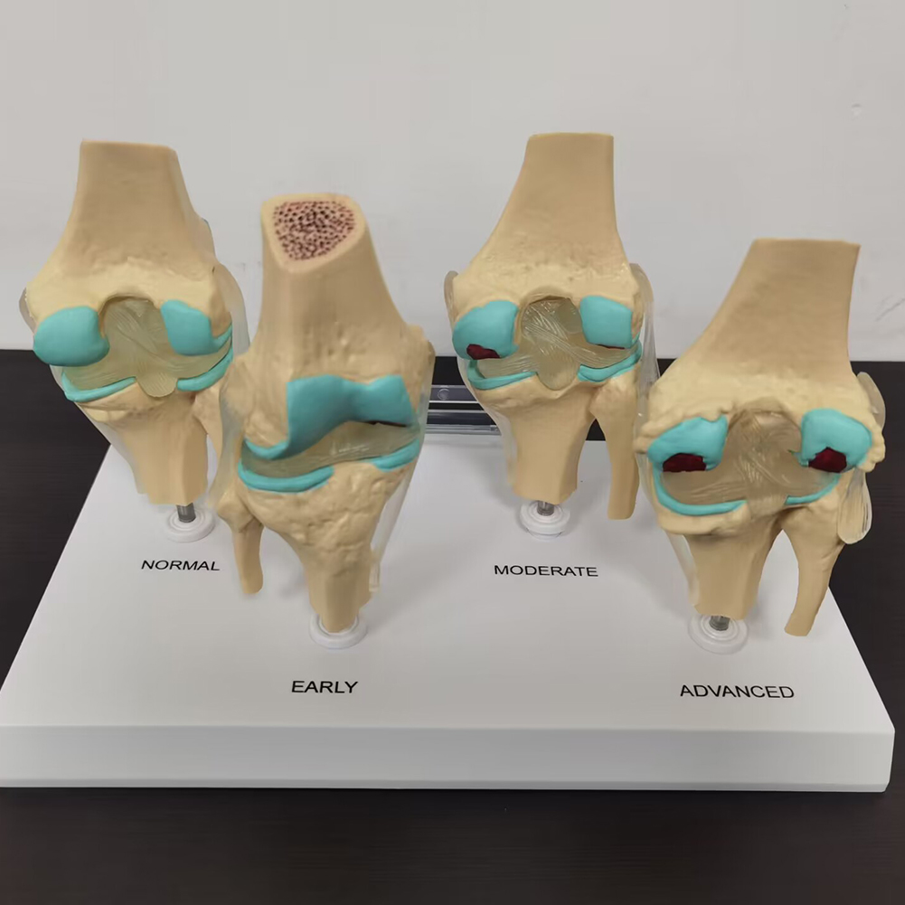 4-stage knee joint model Plast - Medical Lab Technology recension och pris