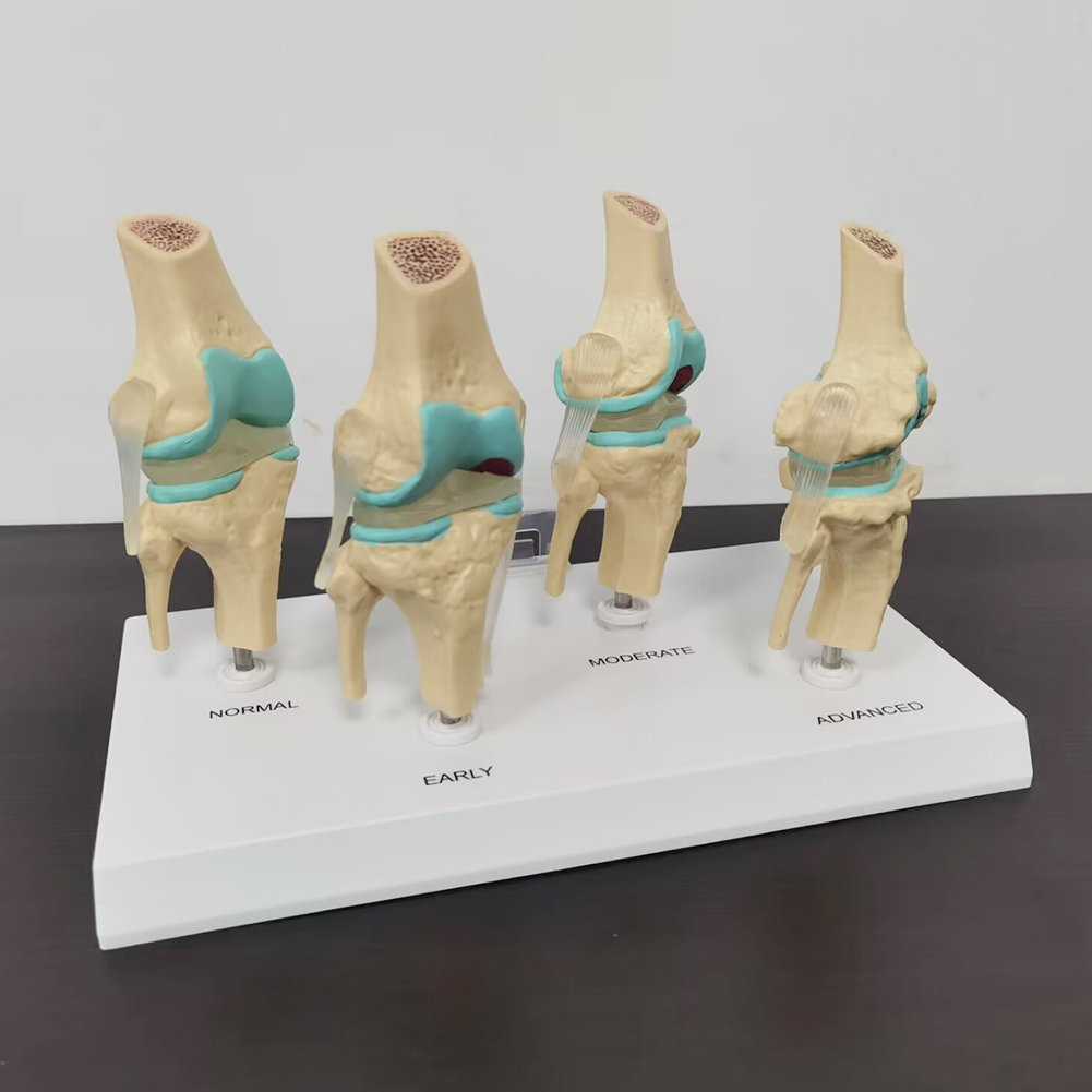 4-stage knee joint model Plast - Medical Lab Technology recension och pris